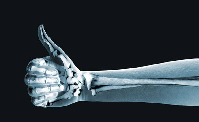 10 loại thực phẩm giúp cho xương chắc khỏe