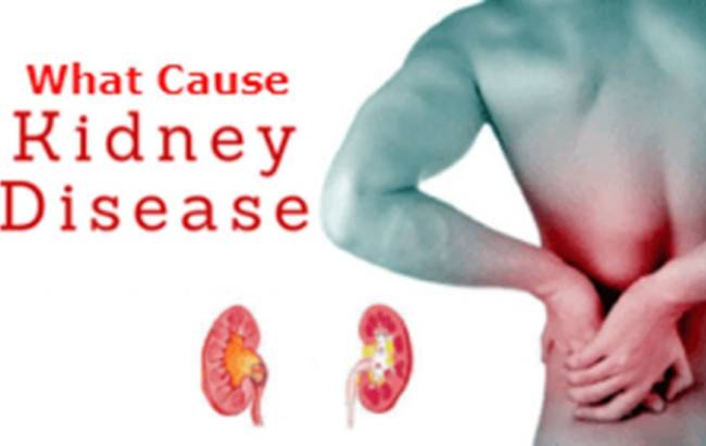 các nguyên nhân chính gây bệnh thận