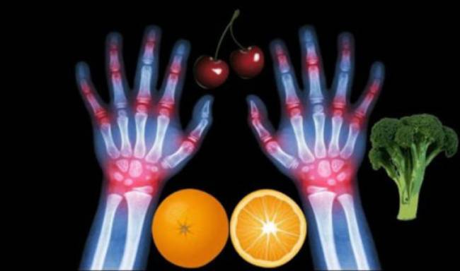 10 thực phẩm tốt nhất cho người bệnh viêm khớp