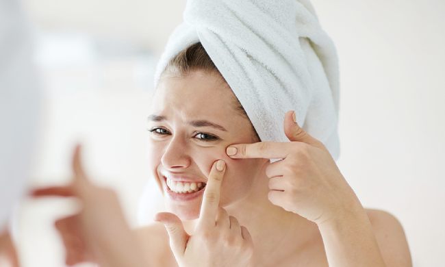 14 cách ngăn ngừa sự hình thành của mụn trứng cá