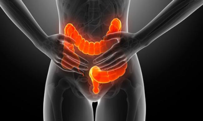 bệnh viêm loét đại tràng có nguy hiểm không