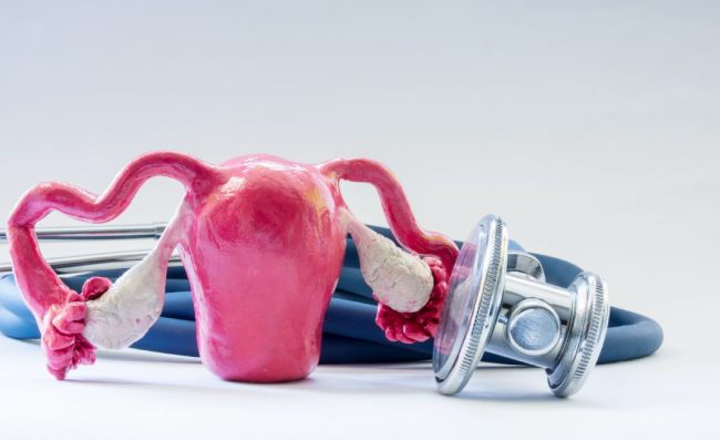 những điều cần biết về lạc nội mạc trong cơ tử cung